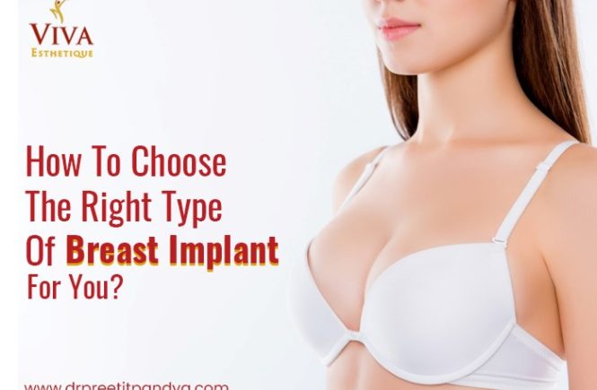 Things You Need To Know About Breast Lift Surgery - Dr Preeti Pandya