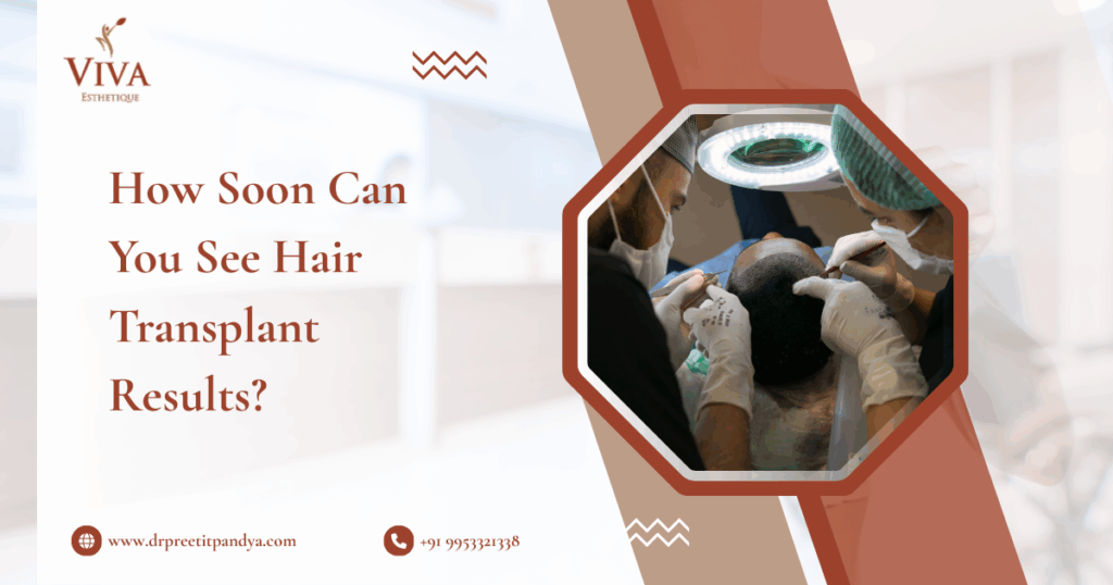 How Soon Can You See Hair Transplant Results- Dr. Preeti Pandya