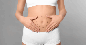 Understanding Tummy Tuck Surgery