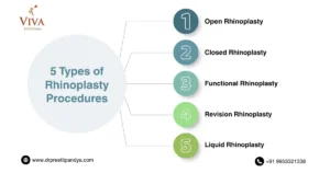 Types of Rhinoplasty