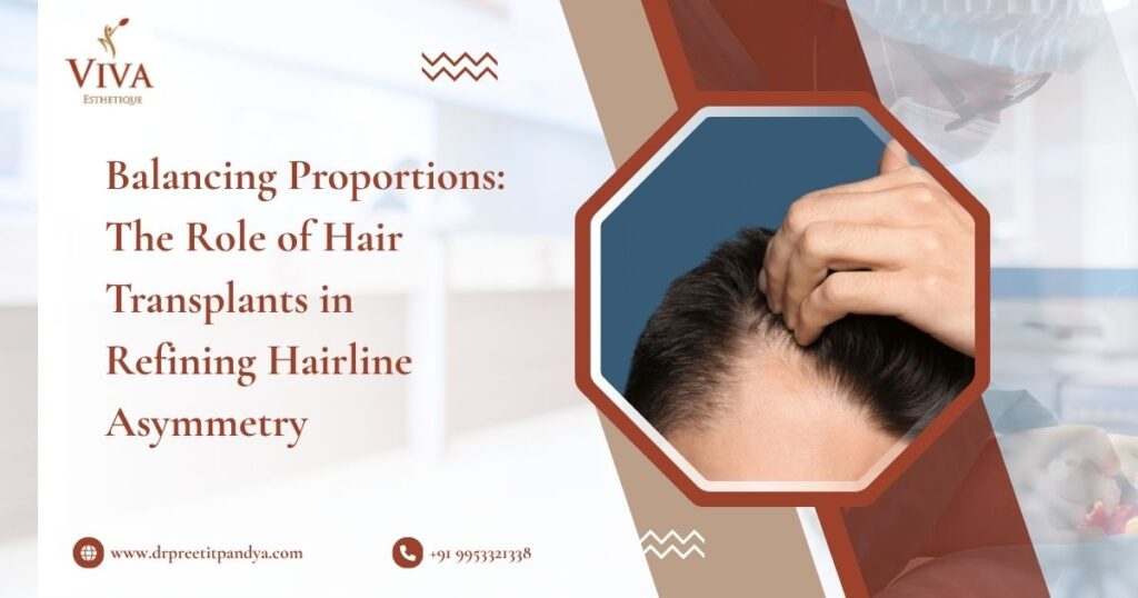 Balancing Proportions: The Role of Hair Transplants in Refining Hairline Asymmetry