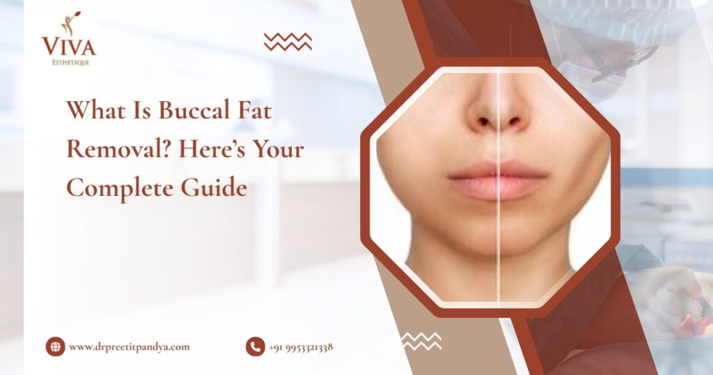 What Is Buccal Fat Removal? Here’s Your Complete Guide
