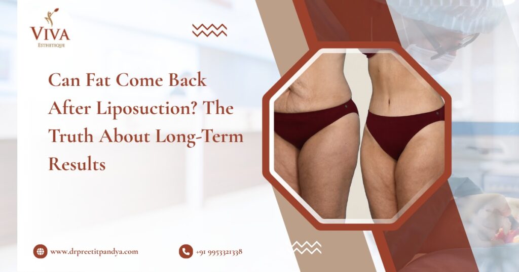 Can Fat Come Back After Liposuction? The Truth About Long-Term Results