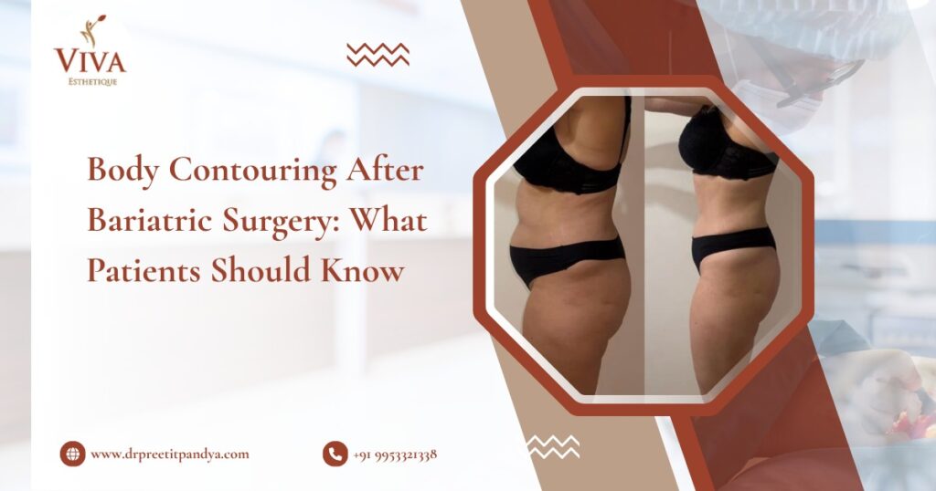 Body Contouring After Bariatric Surgery: What Patients Should Know