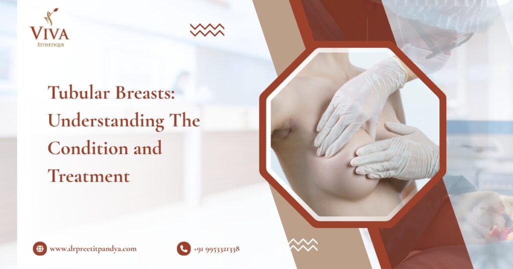 Tubular Breasts: Understanding The Condition and Treatment Options