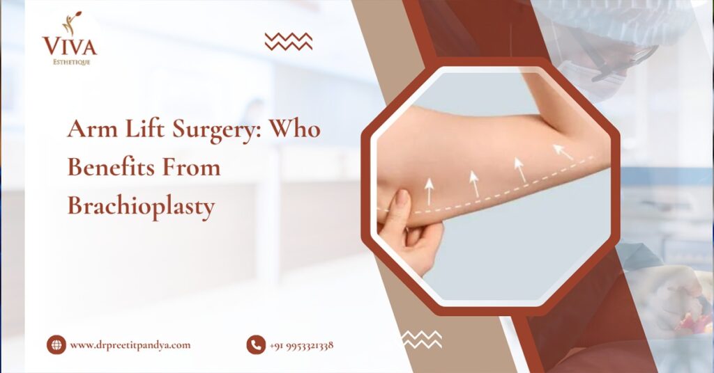 Arm Lift Surgery: Who Benefits From Brachioplasty