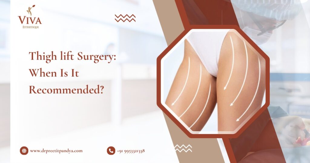 Thigh Lift Surgery: When Is It Recommended?